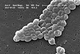 100909Acinetobacter_baumannii[1].jpg